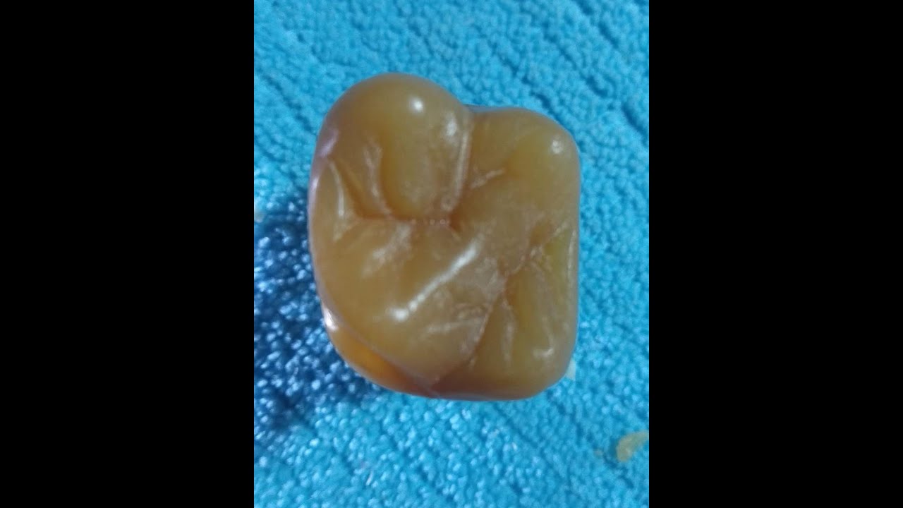 Tallado en Jabón Primer Molar Superior Izquierdo Pieza 26 parte 1