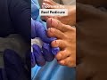 Shorts waterless medical pedicure  aayna foot treatment