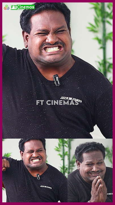 Watermelon Star Diwakar-ன் நவரச நடிப்பு😂 #shorts #drdiwakar #trending#viralvideo #reels #video