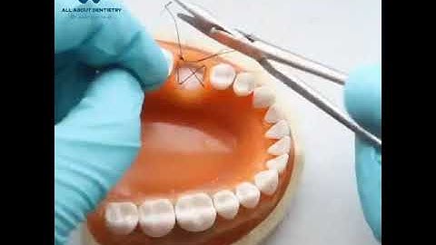 Figure of Eight Suture #dentista #dental#dentistry#oralsurgery #dentalclinicstitch #suturing #needle