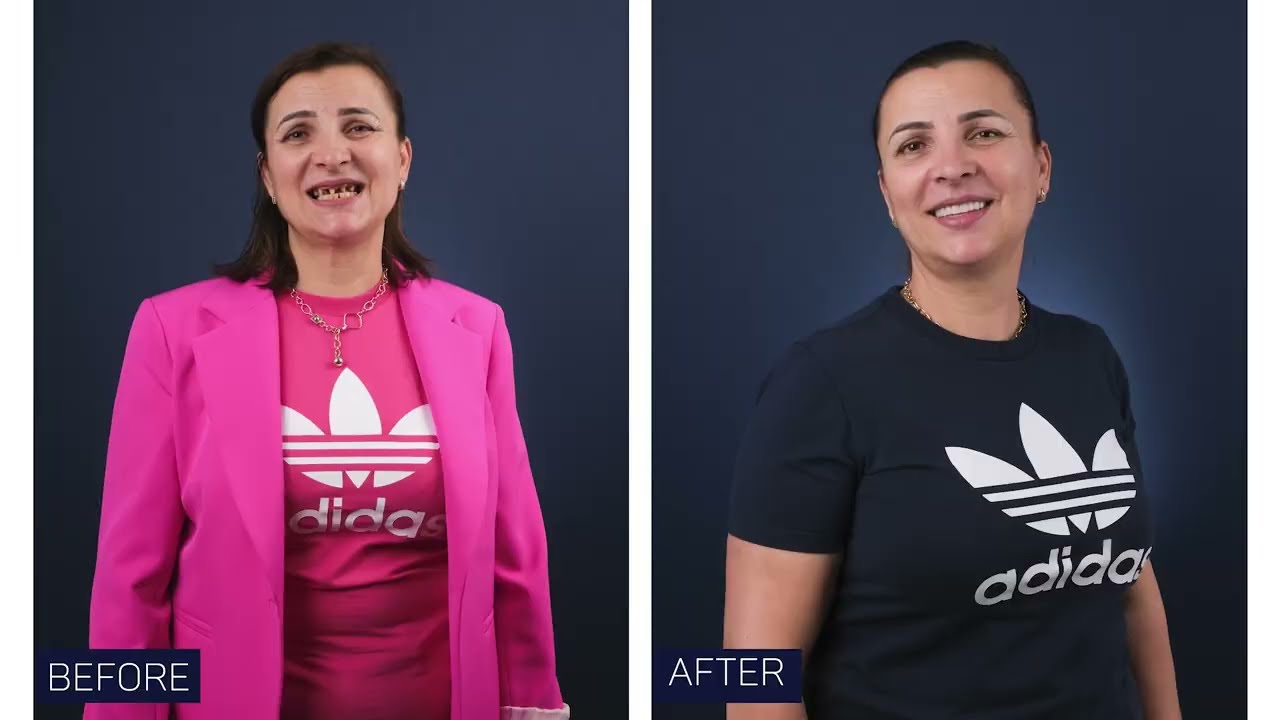 De ce am vizitat OG Dental Clinic Turkey?