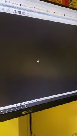 ŞAH DAMARINDA YIRTILMA