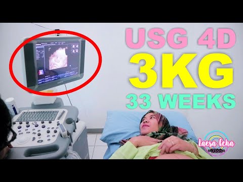 Video: 33 Minggu Kehamilan - Perubahan Janin, Pemeriksaan, Ultrasound