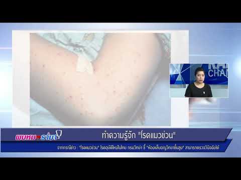 โรคแมวข่วน โรคอุบัติใหม่ในไทย : พบหมอรามา ช่วง Rama Update 18 ส.ค.60 (1/6)