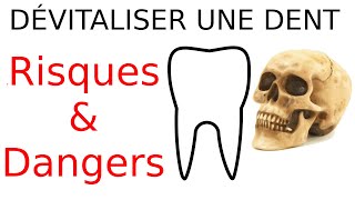 A savoir avant de dévitaliser ta dent Risques & dangers