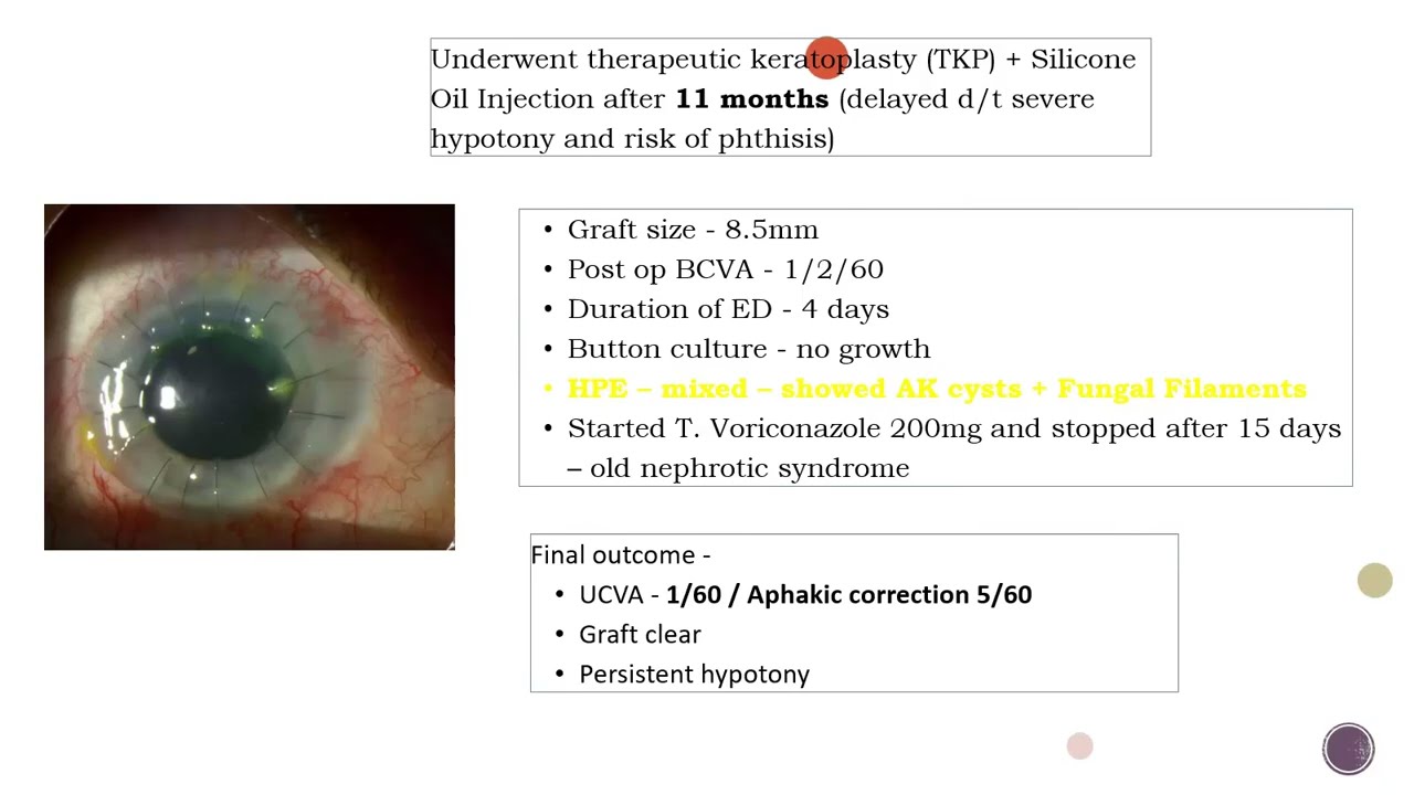 Адъювантная терапия при тяжелых язвах: иммунодепрессанты