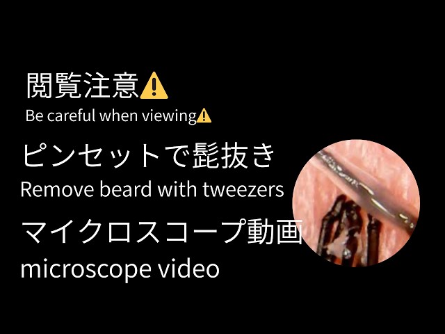 ひげぬき 20190923 ヒゲ抜き - YouTube