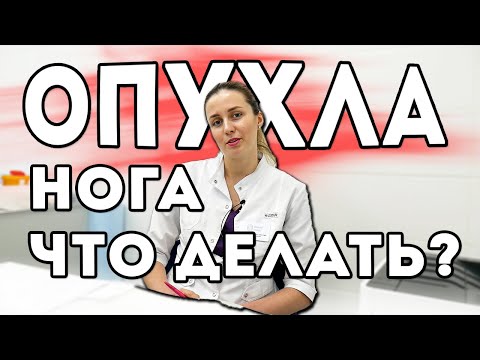 Что делать если опухла нога? К какому врачу идти?