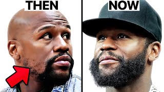 Floyd Mayweather Beard Transplant | Surgeon Reacts