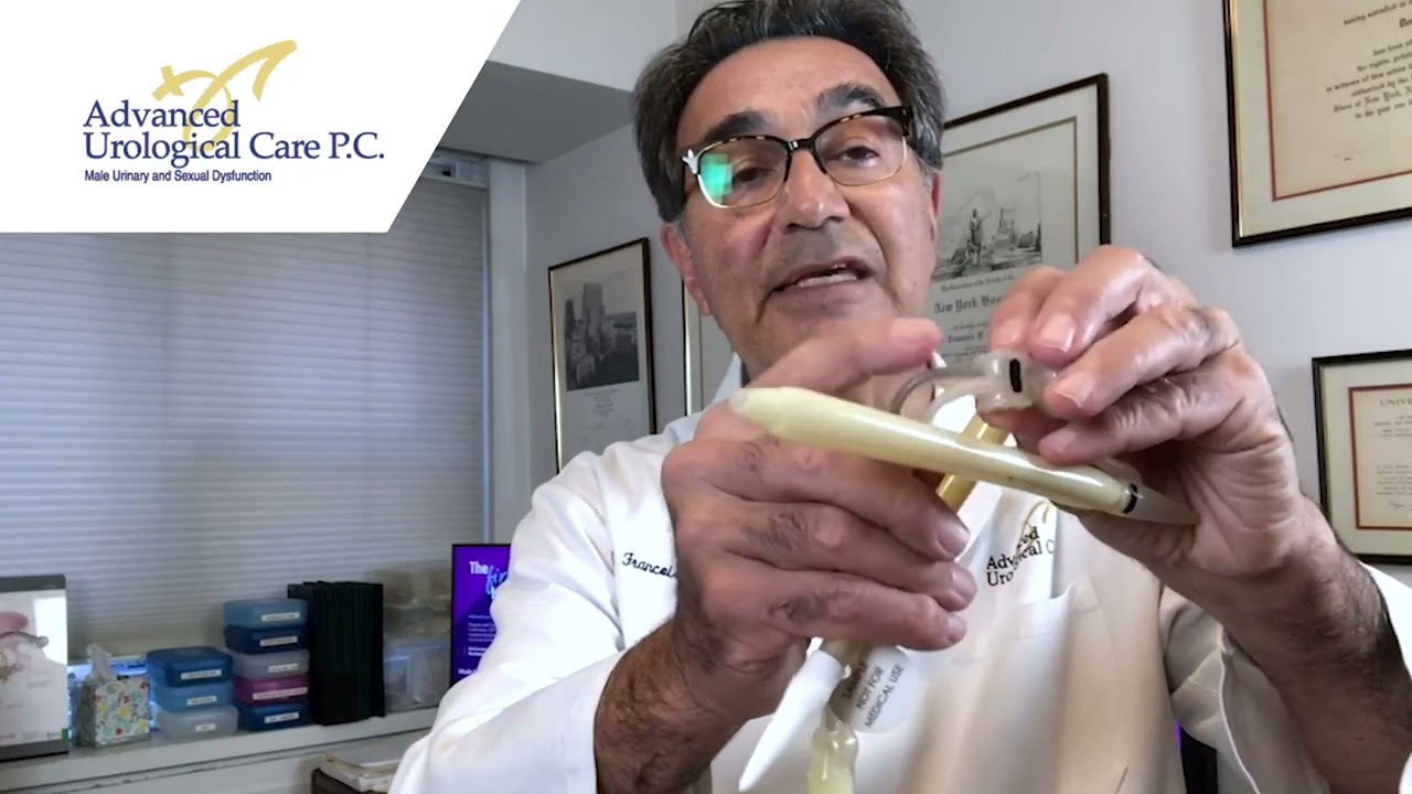 Why penile implants fail