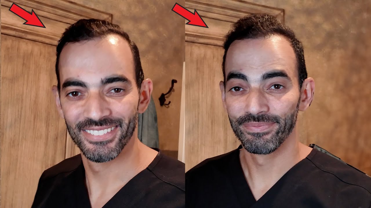 اقوى سيرم طبيعي