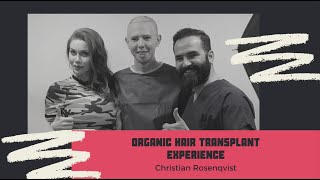 Hair Transplant Experience (Turkish subtitle)