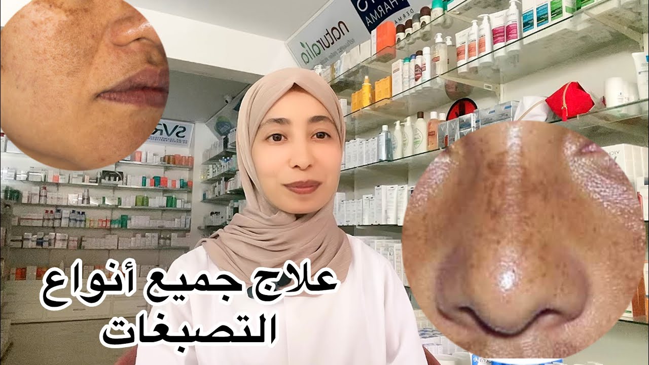 أنواع التصبغات و أفضل الطرق لعلاجها