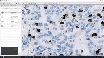 1 - Introduction to QuPath for IHC analysis