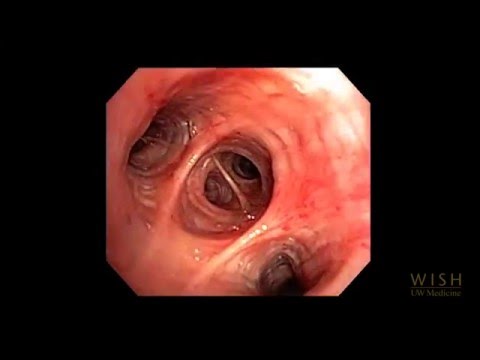 Lower Airway Anatomy - YouTube