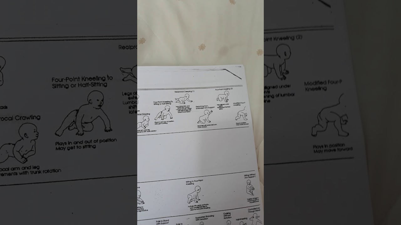 Escala Motora Infantil Alberta