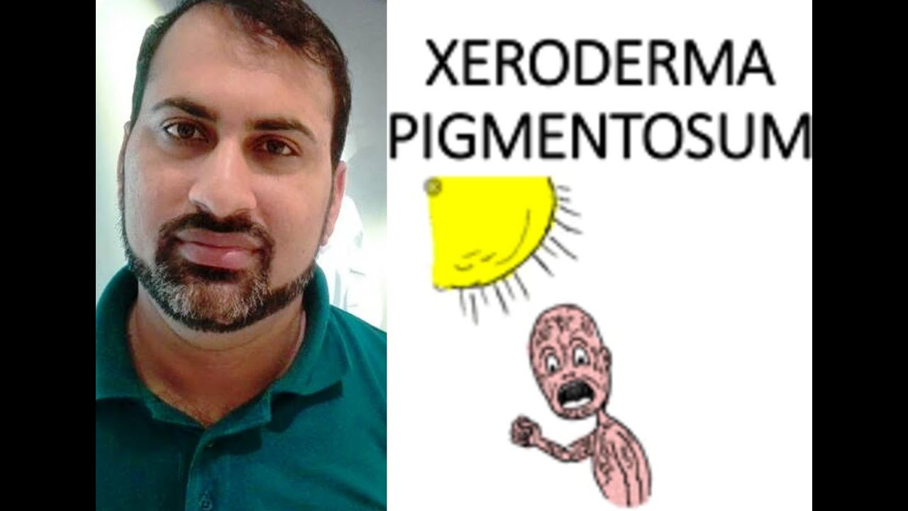 Xeroderma pigmentosum