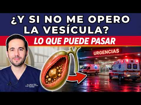 Piedras en la vesícula: riesgos y complicaciones de no operarse