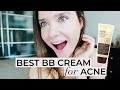 BEST BB CREAM for ACNE Skin and Clogged Pores 🥇