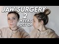 Jaw surgery.... 2 weeks later