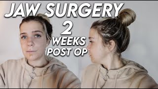 Jaw Surgery.... 2 Weeks Later