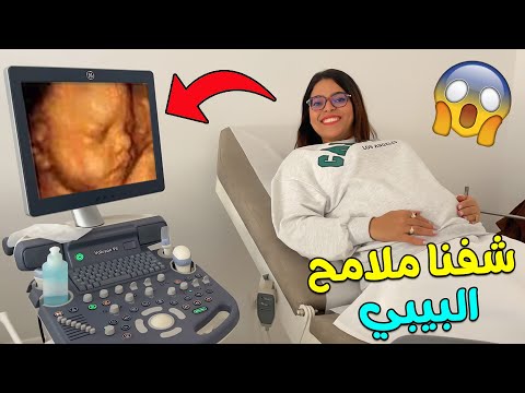 أخيرا شفنا ملامح البيبي الجديد❤ يونس تصدم😱شوفوا لمن كيشبه ‼