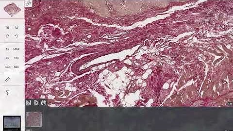 The Histoscan portal for education in pathology