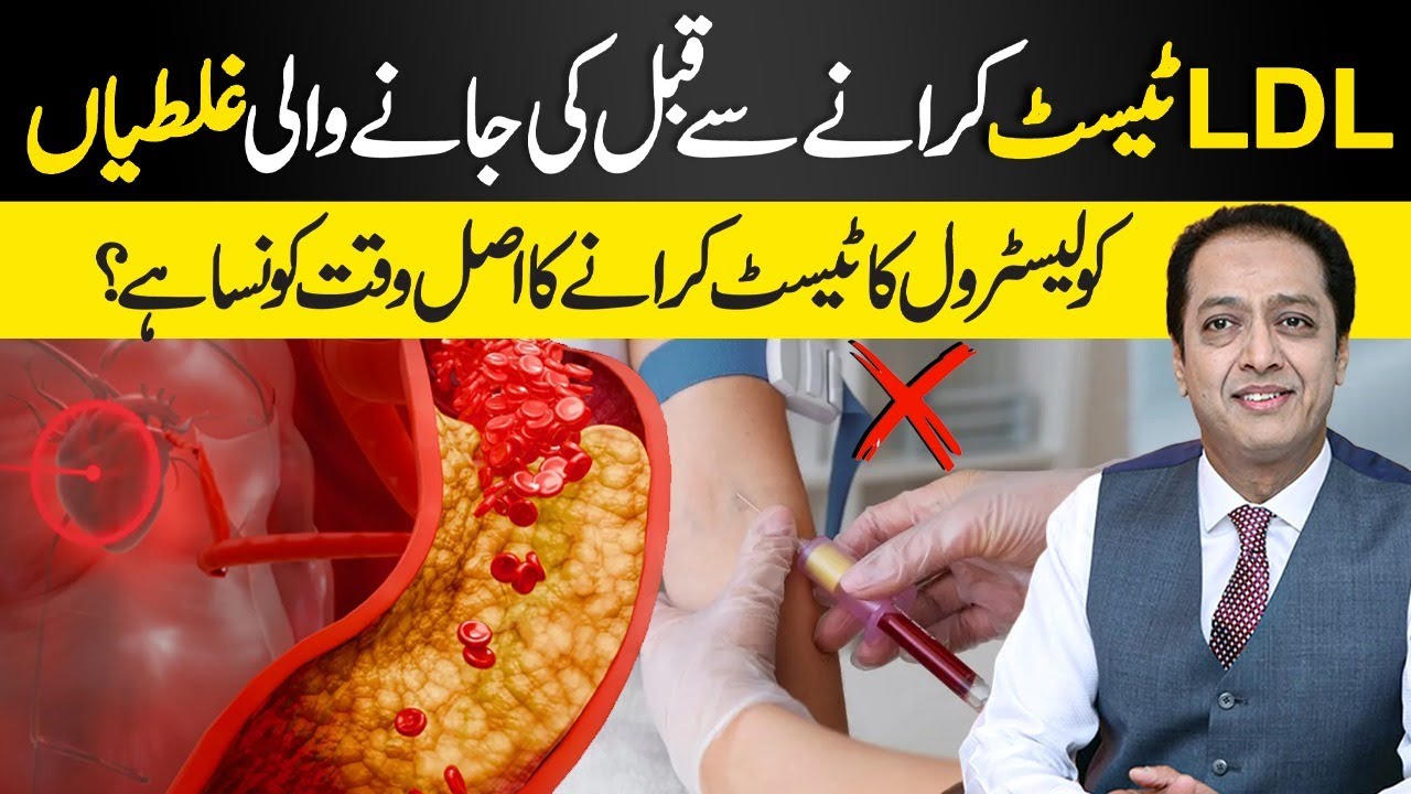 When Is the Right Time for Cholesterol Test? Doctor Explains || Dr Shahid Nadeem