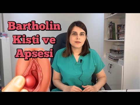 Bartholin Kisti Nedir? Bartholin Kisti Nasıl Geçer? - Op. Dr. Funda Yazıcı Erol