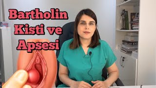 Bartholin Kisti Nedir? Bartholin Kisti Nasıl Geçer? - Op. Dr. Funda Yazıcı Erol