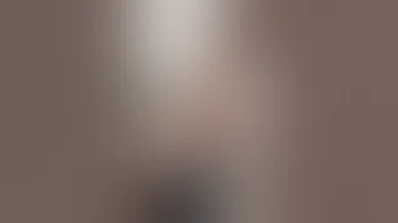 إزالة الوشم 