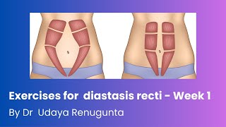 Exercises for diastasis recti Week 1 by Dr Udaya Renugunta