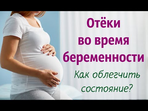 Отёки во время беременности: опасно или нет? / Как облегчить состояние?