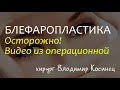 Расширенная блефаропластика с миопексией - хирург Владимир Косинец