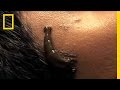 Leeches Cure | National Geographic