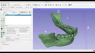 Free & Open-source Software | 3d Slicer | CBCT | Surface Rendering | Mandible With IAN To Stl