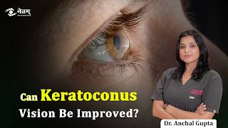 Keratoconus ka Ilaj | Keratoconus vision improvement | Eye Specialist in Delhi