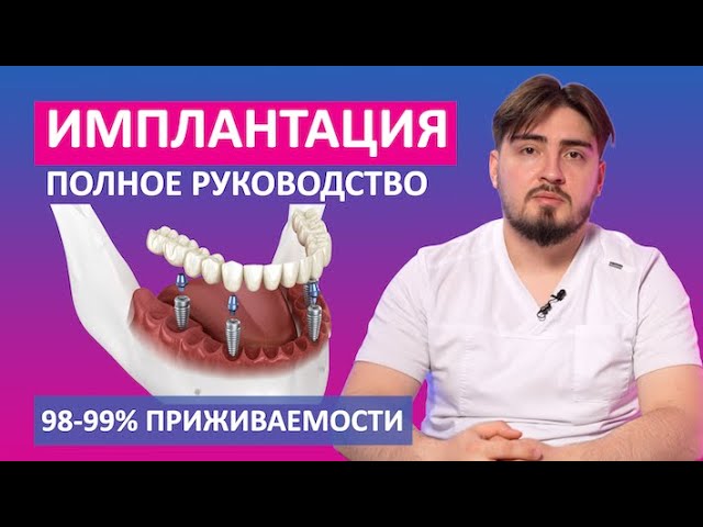 Зубные импланты - виды, цены, сравнение производителей. Стоимость имплантов для зубов.