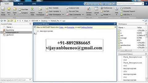 Eye Optic Disk Location Detection