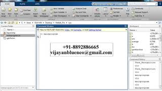 Eye Optic Disk Location Detection screenshot 5