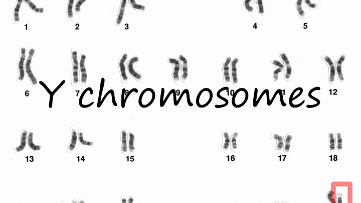 How to Pronounce Y chromosomes?