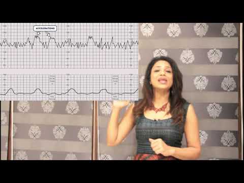 Video: Sådan Dechiffreres CTG Af Fosteret