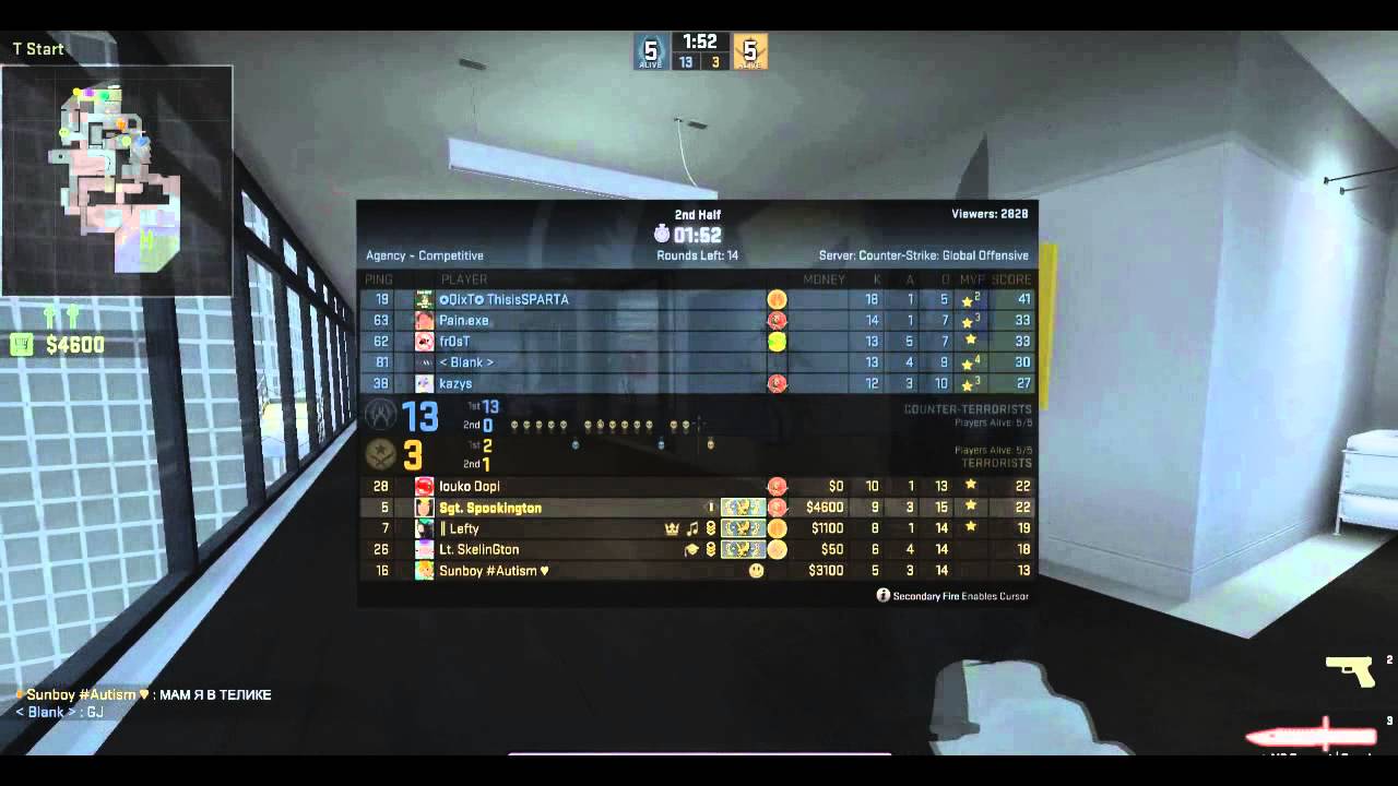 ANOMALY - 1 SECOND GLOCK-18 ACE! :O