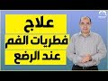 علاج الفطريات في الفم عند الرضع