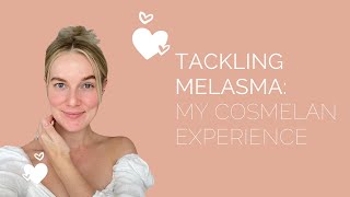 Tackling Melasma: My Cosmelan Experience