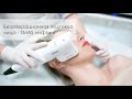 Безоперационная подтяжка лица и шеи - Ультразвуковой SMAS лифтинг на аппарате Liftera A