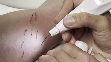 THE POTENCY OF PURE PLASMA | PLEXR PLUS