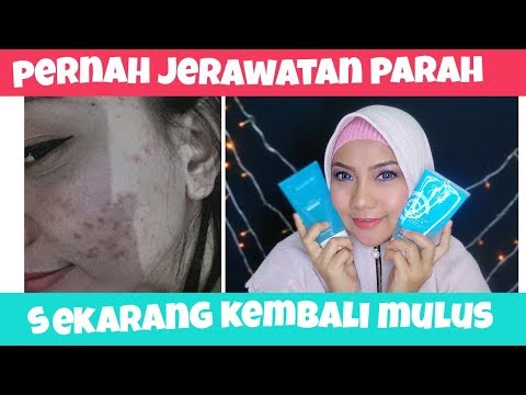 1 MENIT NGERINGIN JERAWAT DAN MENGHILANGKAN NODA BEKAS JERAWAT (PURE SKIN MASKER ORIFLAME). 