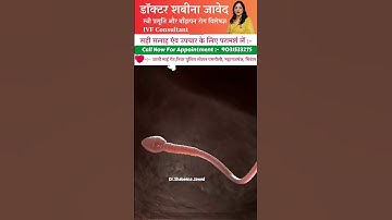 process of meeting sperm with egg.🔥  #shorts  #trending  #shortsfeed #ytshorts