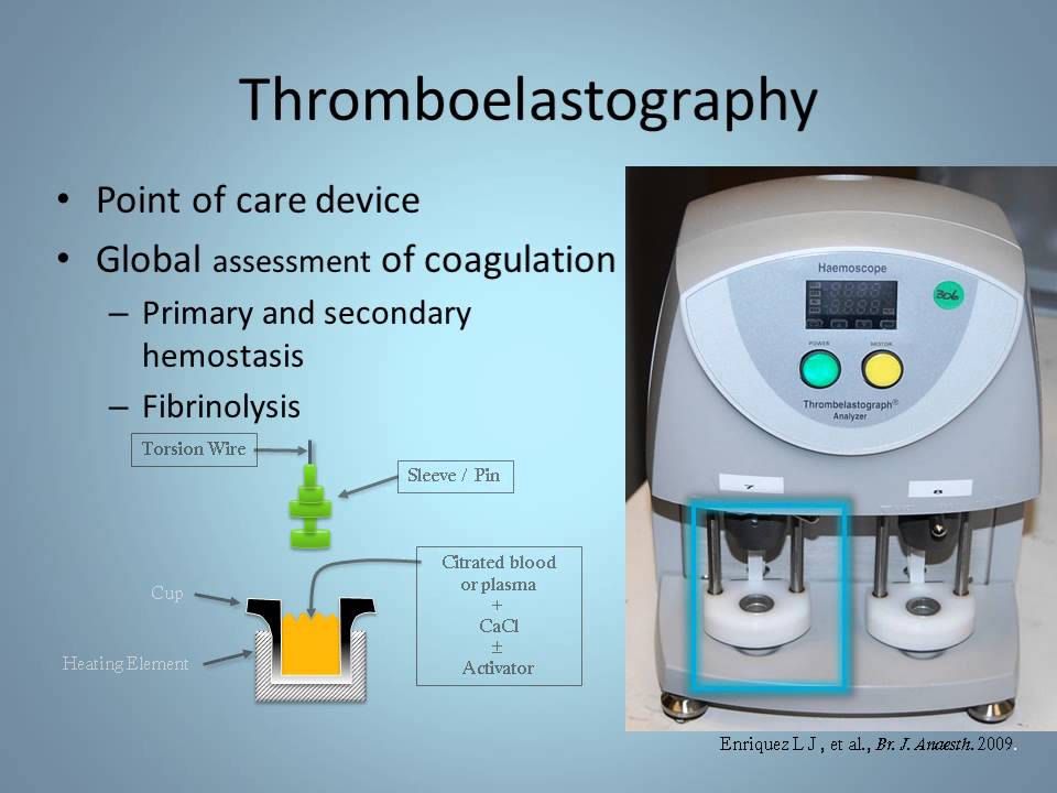 Video1 TEG Procedure YouTube